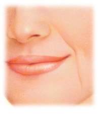 Injectable Fillers e.g. Perlane, Prevelle, Juvederm, Restylane by Seattle Plastic Surgeon